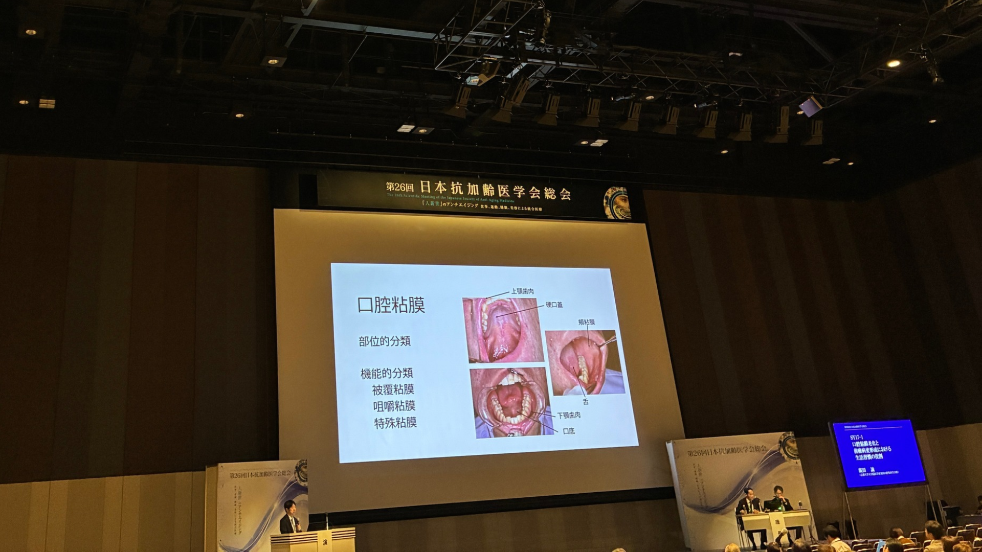 口腔粘膜の部位的・機能的分類について解説